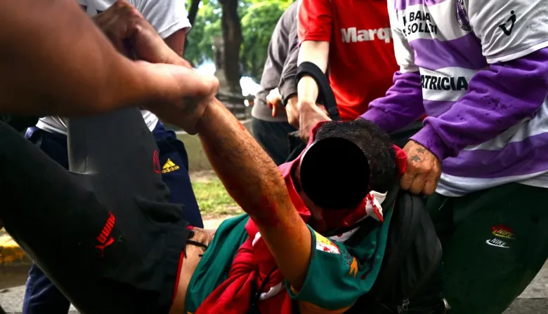 Parte médico de Pablo Grillo, el fotógrafo atacado por policías en la marcha de los jubilados