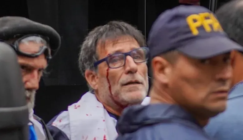 Marcha de los jubilados: otra vez se produjeron incidentes y el padre Paco resultó herido