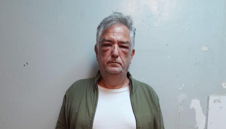 La caída de Miguel Calvete: aparece la primera imagen detenido tras años sin condena