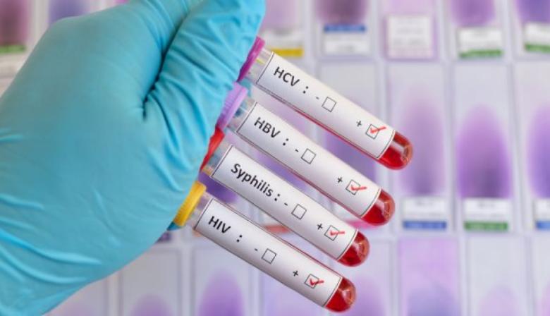 Colegio de Médicos de Buenos Aires exige campañas contra el crecimiento de ETS