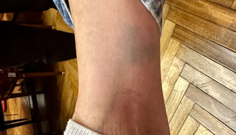 Golpes y manoseos: sigue el escándalo por el despacho de Cristina López en el Senado