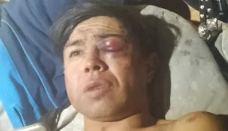 Desfigurado en Navidad: apuran a Weretilnek tras la denuncia contra la Policía de Río Negro