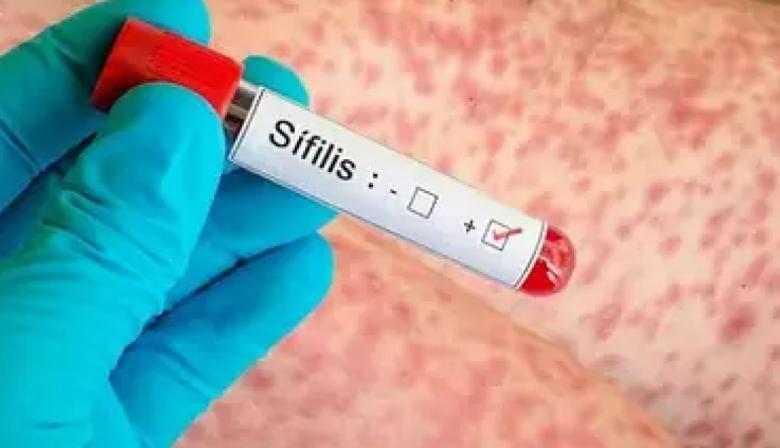 Alarma por sífilis en mujeres: aumentan un 26% los casos y crecen las reinfecciones