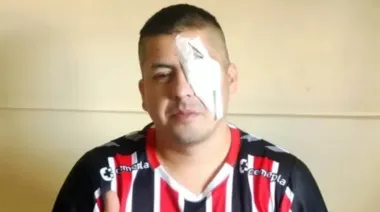 Un hincha de Chacarita denunció a Patricia Bullrich tras perder un ojo por la represión en el Congreso