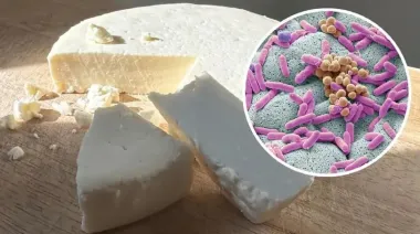 Listeriosis: todo lo que hay que saber sobre esta enfermedad transmitida por alimentos