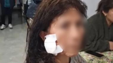 Una turista fue atacada con un ladrillo en la AU Riccheri camino a Ezeiza