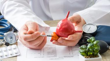 Aprueban en Argentina nueva terapia de precisión contra el cáncer de próstata