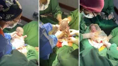 Nacieron trigemelas en Salta, un parto que ocurre cada millón de embarazos