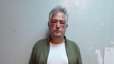 La caída de Miguel Calvete: aparece la primera imagen detenido tras años sin condena