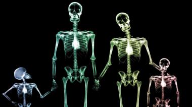 ¿Quién es Wilhelm Röntgen? La historia detrás de los rayos X y su legado