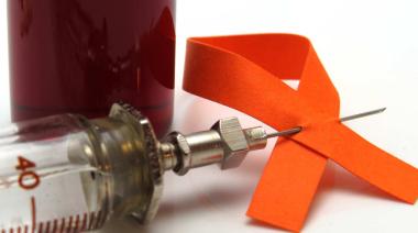 1 de diciembre: ¿conocés la diferencia entre VIH y sida?