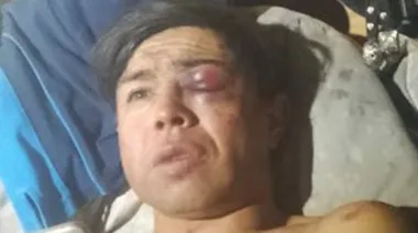 Desfigurado en Navidad: apuran a Weretilnek tras la denuncia contra la Policía de Río Negro