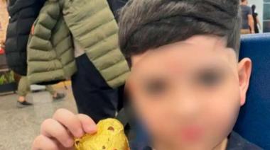 Tras el choque en La Frontera, operan nuevamente al niño de 8 años