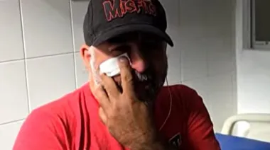 Agresión a camarógrafo en el Congreso: evalúan sanciones a jefes de la Policía Federal