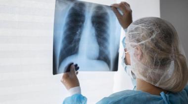 Mar del Plata: activan protocolos sanitarios por caso de tuberculosis