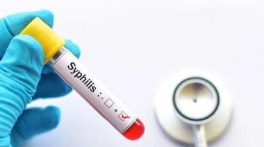 Argentina registró 46.799 casos de sífilis: su expansión entre jóvenes