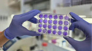 El dengue cae 58% en América: qué países explican la mejora