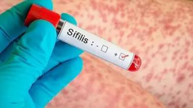 Alarma por sífilis en mujeres: aumentan un 26% los casos y crecen las reinfecciones