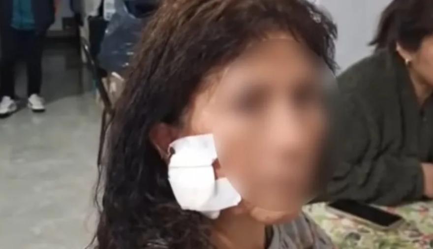 Una turista fue atacada con un ladrillo en la AU Riccheri camino a Ezeiza