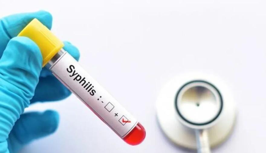 Argentina registró 46.799 casos de sífilis: su expansión entre jóvenes