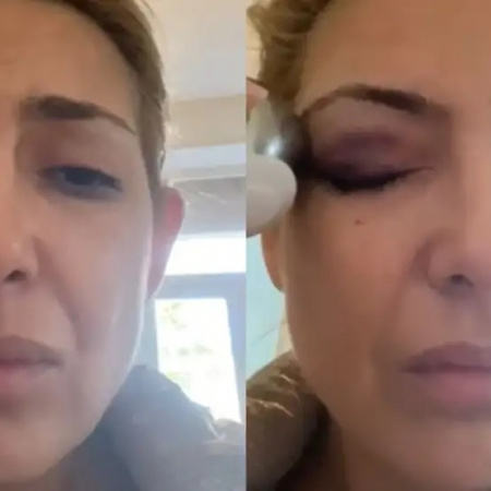 Aparecieron nuevas imágenes de Fabiola Yañez con golpes que se suman a la causa por violencia de género contra Alberto Fernández