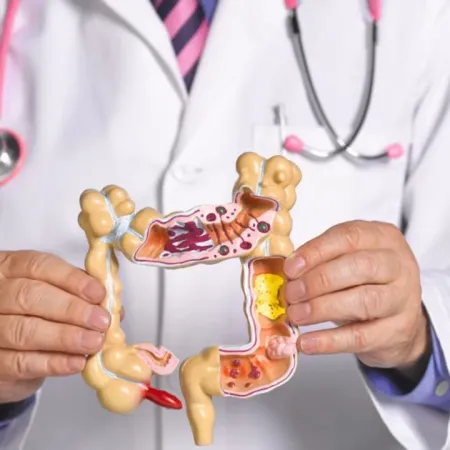 Instalan una cabina de fotos para promover la prevención y detección temprana del cáncer de colon