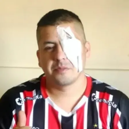 Un hincha de Chacarita denunció a Patricia Bullrich tras perder un ojo por la represión en el Congreso