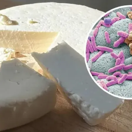Listeriosis: todo lo que hay que saber sobre esta enfermedad transmitida por alimentos