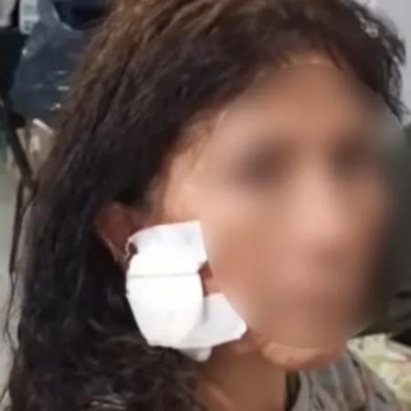 Una turista fue atacada con un ladrillo en la AU Riccheri camino a Ezeiza