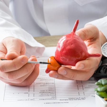 Aprueban en Argentina nueva terapia de precisión contra el cáncer de próstata