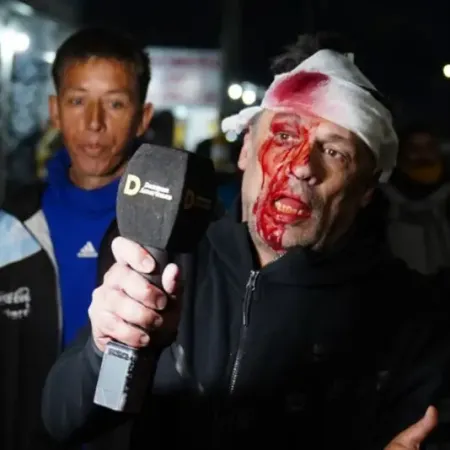 Brutal ataque a un periodista en el acto de Milei en Moreno: lo golpearon y terminó con el rostro ensangrentado