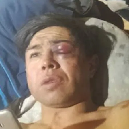 Desfigurado en Navidad: apuran a Weretilnek tras la denuncia contra la Policía de Río Negro