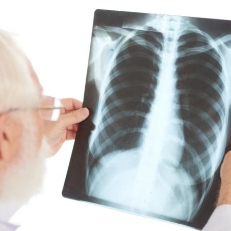 Ministerio de Salud actualizó el manual de tuberculosis tras 11 años sin cambios