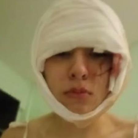 La chica a la que quisieron matar a cuchillazos: el antecedente de bullying extremo en San Cristóbal