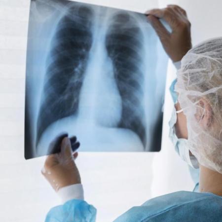 Mar del Plata: activan protocolos sanitarios por caso de tuberculosis