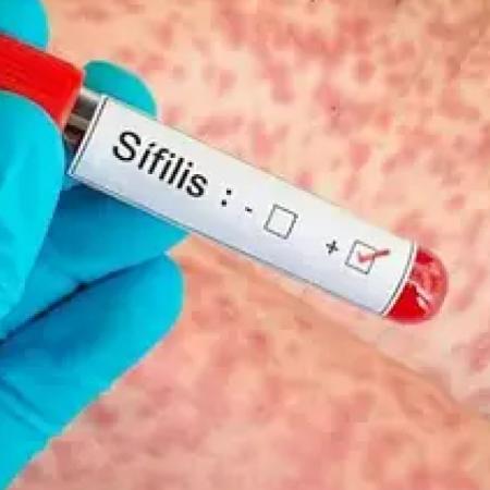 Alarma por sífilis en mujeres: aumentan un 26% los casos y crecen las reinfecciones