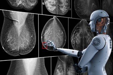 Científicos aseguran que la Inteligencia Artificial puede ayudar a la detección del cáncer de mama
